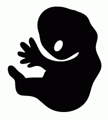 Baby With Soft Bone